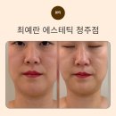 최예란 에스테틱 | 우암동 피부관리 최예란에스테틱 윤곽관리 후기