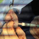 (주)라온메디칼 이미지