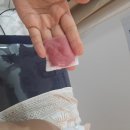 비겐바디케어수원화서점 | 수원 웨딩관리 화서 윤곽추천 예민&amp;문제성 피부 맞춤 진정 케어 후기