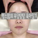 뷰티호텔286 | [울산 북구 에스테틱] 뷰티호텔 286 재생케어 후기(모낭충 주의!)
