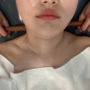 빈스탑 | 김해피부관리 빈스뷰티 작은얼굴관리 받고 턱선이 달라졌어요!