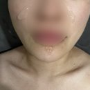 덕진-133 | 전주 피부관리, 전주 피부 관리실 경력 많은 원장님의 1:1 관리 원스킨케어