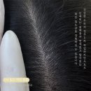 수원-1679 | 수원 두피커버 잘하는곳 오해피브로우에서 정수리 숱채움 했어요