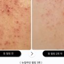 고고에스테틱