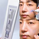 코 얼굴 모공줄이는 법 니들샷 화장품 쿠피 아줄렌 바눌에센스 후기