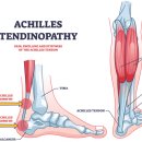 하한의원 | [구로구 고척동, 오류동 도수치료] 발목통증, 왜 생기고 어떻게 회복할까?