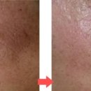 메디퀸즈 이미지