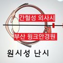 대학병원안경원 이미지