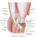 표면후방선(superficial back line) 이미지