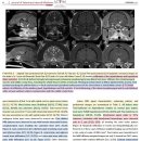 신경계를 포함하는 lymphoma가 있는 고양이에서 임상적 & MRI features 이미지