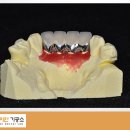 다이안치과기공소 이미지