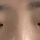 까진속눈썹