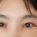 우종설성형외과