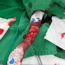 성내동물병원 | 강아지 연부조직육종 빠른 진행속도 종양 제거 수술 후...