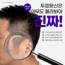 탈모왕수원