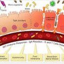 만병근원 장누수 증후군 (Leaky Gut Syndrome) 이미지