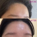 마린시티3로 | 해운대 마린시티 라운에스테틱 물방울 관리 솔직후기