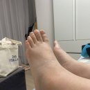 딱경희한의원 | 딱 경희한의원 후기