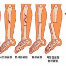 개방성 골절의 정의, 증상, 원인 및 치료 이미지