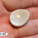 코리아의안센터 이미지