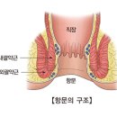 변실금(Fecal incontinence) 이미지