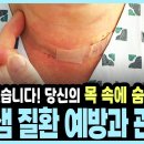 단순 갱년기? 남성도 안전지대 아니다! 절대 놓치면 안 되는 갑상샘 신호 이미지