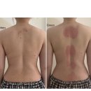 청솔메디칼 | 범어동 에스테틱 수성구 다이어트 관리 내돈내산 솔직 후기