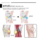 슬한의원 네이버블로그
