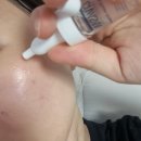 HY메디 | 에스테틱샵에서 실제 사용하는 시바산 발삼키트 효과, 앰플 4주 사용 솔직후기