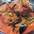 역전등뼈 이미지