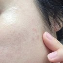 기쁜약국 | 약국 재생크림 본토닉으로 피부 속부터 자생력 키우기