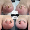 페디베네 이미지