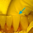 복음치과기공소 이미지