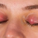 청주퍼스트안과의원 이미지