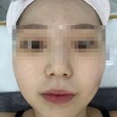 뷰티제이의원 | 익산 피부관리와 신부관리는 어썸제이!