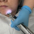 스마일화장품 | 인계동피부관리 인계동여드름 인계동좁쌀여드름 | 인계동 스마일 뷰티 여드름관리 체험 후기