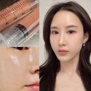 강남 서초동 피부과 노바셀 SVF 지방 줄기세포 주사 가격 효과 후기