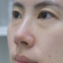 진해구 ⓒ-40 | 쿠피 : 2주기미크림 멜라스마클리어크림 사용 후기