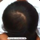 엔젤아이의원 이미지