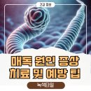 &#34;매독에 대한 완벽 가이드: 원인, 증상, 치료 및 예방&#34;