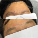 퓨어라인 네이버블로그