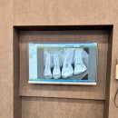 교대사랑이치과의원 | 교대역 사랑니, 신경치료 잘하는 치과 교대사랑이치과 리얼감동후기, 전원 3번만에 찾은 신경치료치과...