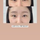오브앤브로우