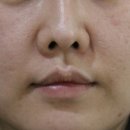 연세로즈의원 이미지