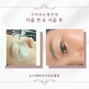 감탄토평점 | 구리속눈썹연장으로 눈매 선명하게, 눈이예쁘다구리토평점 솔직후기