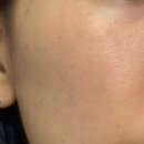 한 사람 | 리투오 스킨부스터 리얼 생생 한달 후기!! 고민하는 사람들 다 들어오삼