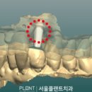 더플랜트치과의원 이미지