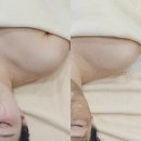 지에스25 경산부영점 | 경산피부관리 ㅣ트러블 색소관리 수분관리 받고 온 후기 물오른뷰티 경산점
