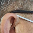 목동독일보청기 이미지