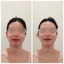 동구-3 | 울산 ❘ 울산 동구 신부 관리 잘하는 가온 에스테틱 ❘ 울산 동구 신부 관리 3회차 후기